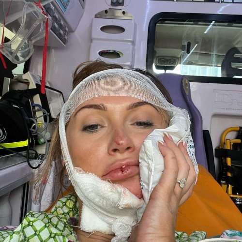 Charlotte Dawson Rushed To Hospital In Rome After Nasty Scooter Accident Flipboard