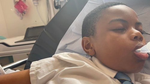 My son, 11, had to have his finger AMPUTATED after he was ‘attacked by gang of bullies at school’