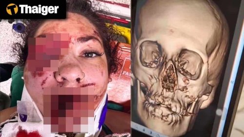 Thailand video news | US nurse suffers devastating injuries in Krabi moped crash, Myanmar quake deaths pass 3,000 as junta leader visits Bangkok