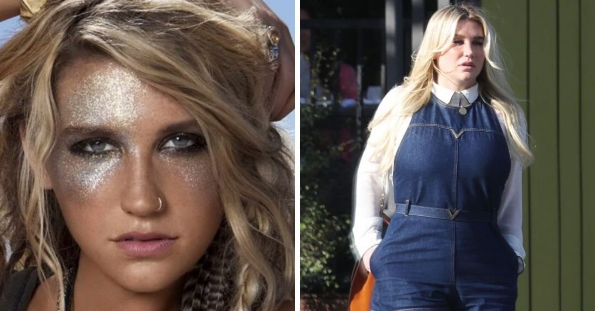 20 Things Everyone Forgets About Kesha