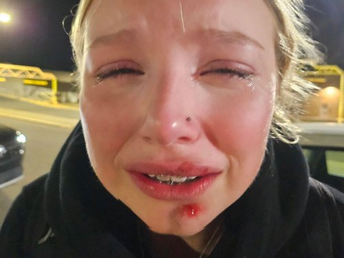 Questions Abound in Violent Edmonton Police Takedown of Teen Girl