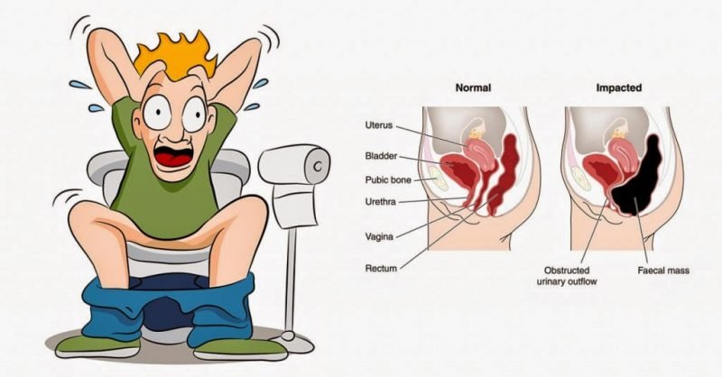 Can I Use Prunes and Potassium to Treat My Constipation?