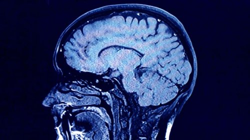 Experimental drug shown to 'significantly' slow progression of brain cancer