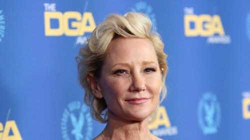 Anne Heche Severely Burned in Fire After Crashing Car Into 2 L.A. Residences (Reports)