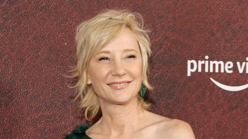 Anne Heche ‘Not Expected to Survive’ Due to ‘Severe’ Brain Injury, Representatives Say