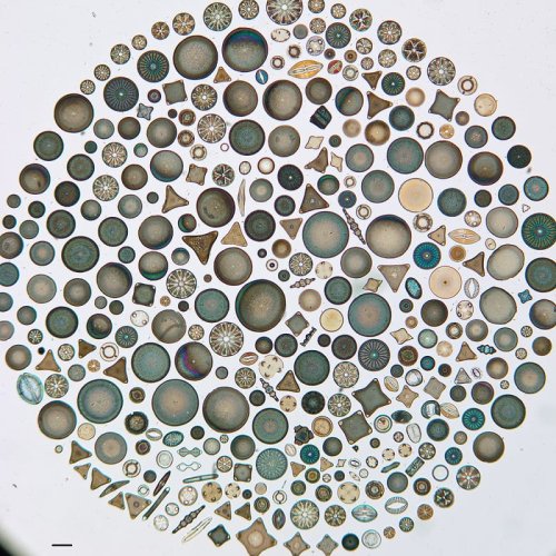 Artistic Arrangements of Microscopic Algae Viewed Through a Microscope — Colossal