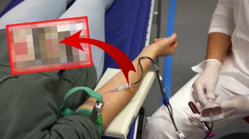 Gera: Blutspendezentrum zeigt krasses Bild – „Drei extreme Beispiele“