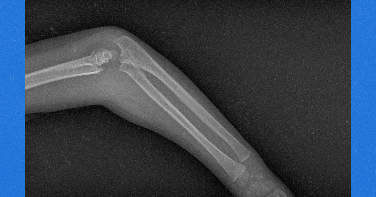 12 Weird Symptoms Endocrinologists Say You Should Never Ignore Flipboard