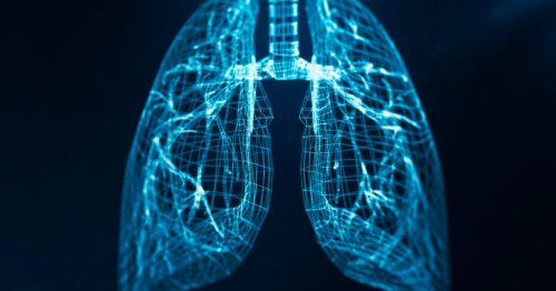 Lung Cancer Screening Can Catch Tumors When They're Curable, New Research Finds