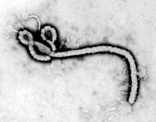Ebola: The First Glimpse of a Virus