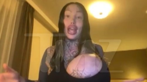 Uni-Boob IG Model I'm Not Mentally Ill ... Body Morphing Was My 'Extreme Sport'