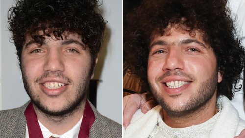 Benny Blanco Good Genes Or Good Docs?!