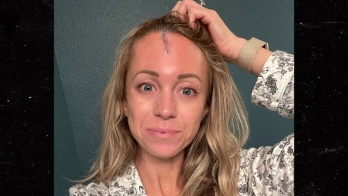 MLB Reporter Kelsey Wingert Hit In Head By Line Drive ... Reveals Gnarly Injury In Pic
