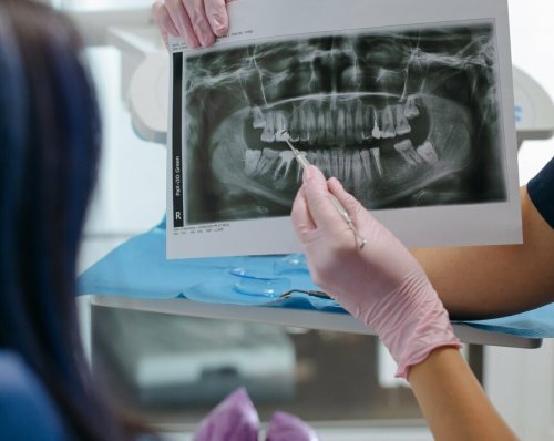 Here are the Groups Who Will Receive Free Canadian Dental Care in 2023