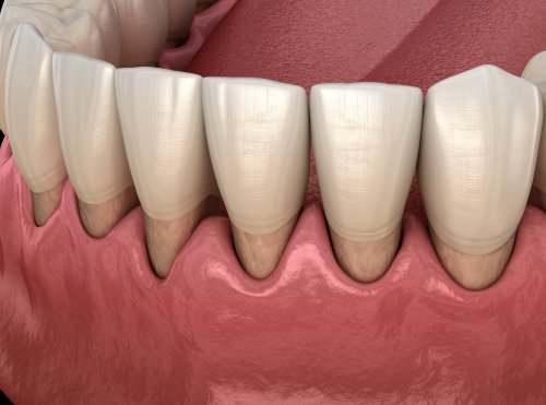 Israeli foam to reverse receding gums soon set for human use, after success on dogs