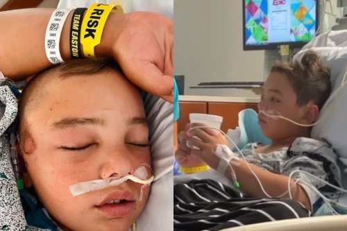 LLWS Player That Was In Coma is Talking & Eating After Having Surgery on Head Injury (VIDEO)