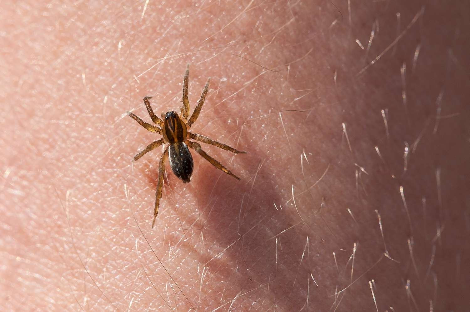 A Woman Was Bitten by Spiders on a Lakeside Family Trip—Nearly 3 Months Later, She’s Still Fighting for Her Health
