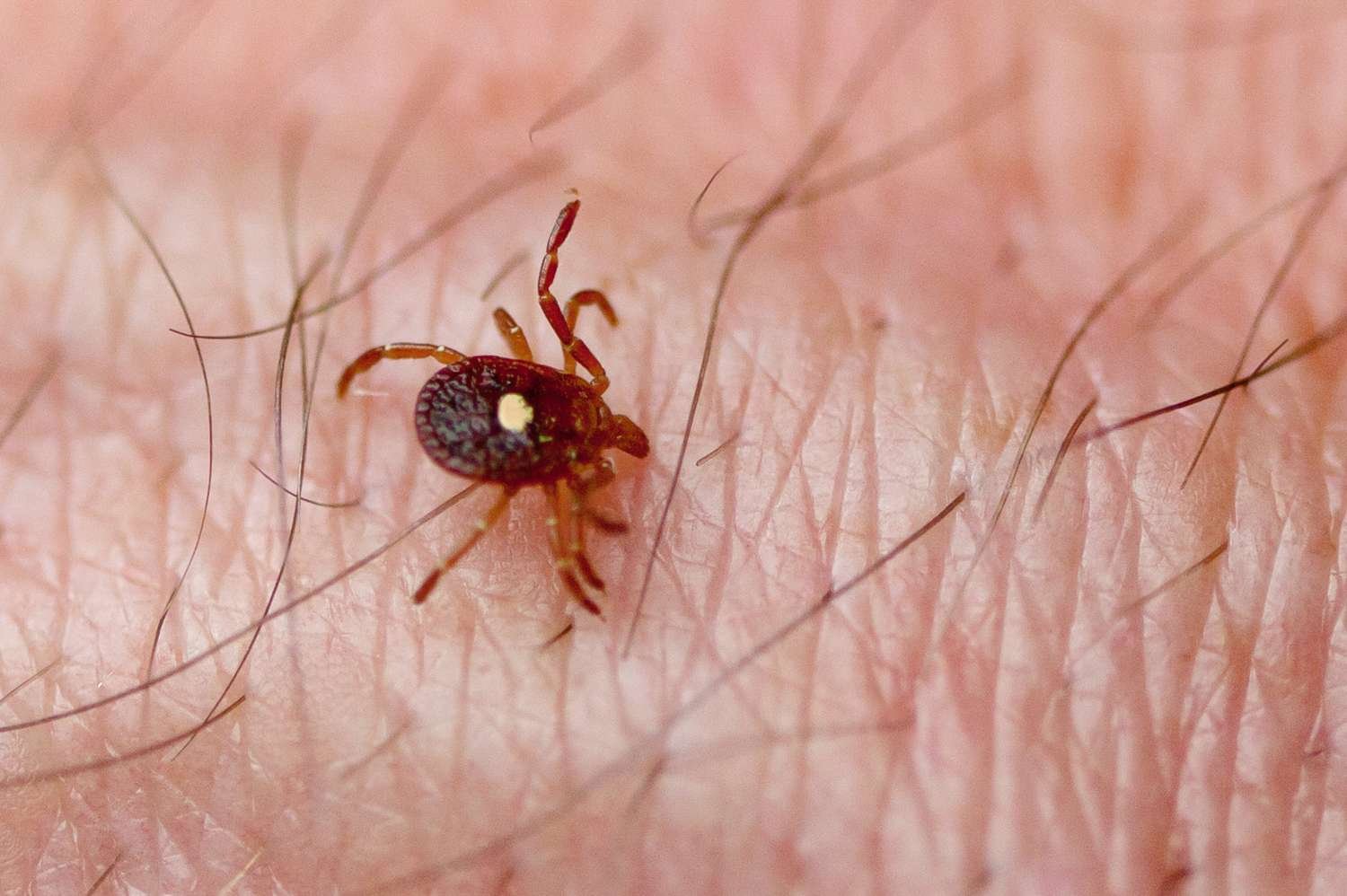 A Rare Tick-borne Virus That Can Be Fatal Was Just Confirmed in New York—Here’s What Travelers Should Know