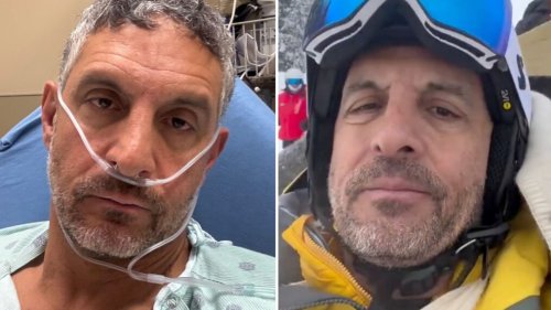 ‘RHOBH’ Star Mauricio Umansky Hospitalized After Breaking Clavicle While Skiing