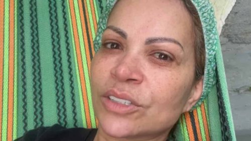 Solange Almeida é submetida a cirurgia de emergência