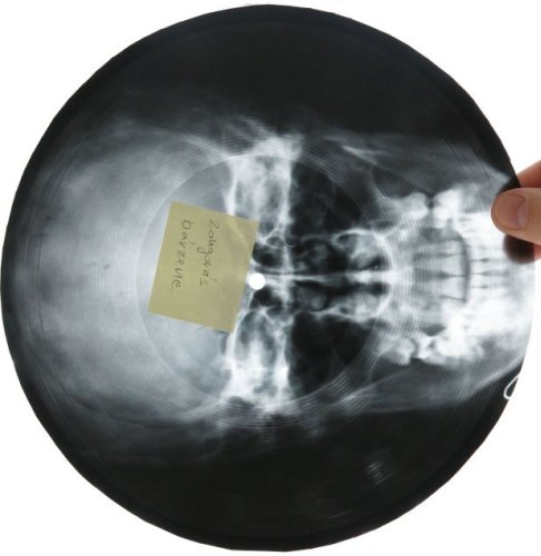 A história bizarra dos discos de raio X e o começo da pirataria de música