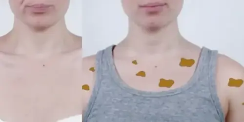 What happens when you stop bathing