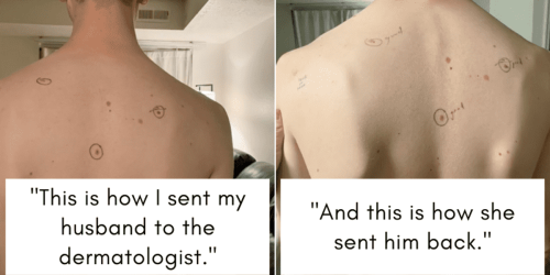 His wife sent him to the dermatologist covered in circles—turns out, she may have saved his life