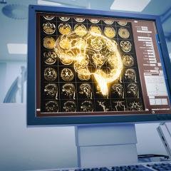 Improving brain function using ultrasound