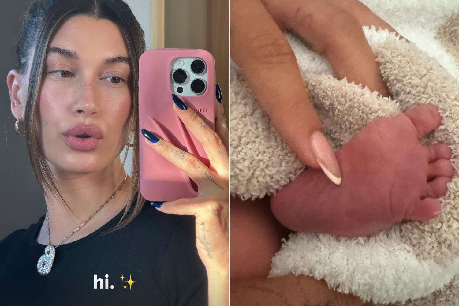 How Hailey Bieber Suffered Deadly Postpartum Complication After Son Jack’s Birth