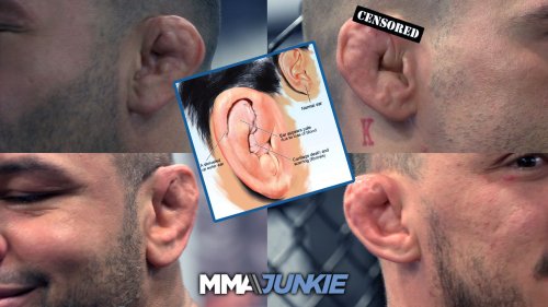 Video: UFC fighters share first cauliflower ear experience and painful aftermath