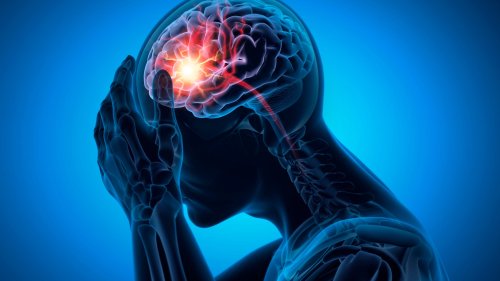 A stroke can lead to severe damage and even death. But what causes a stroke?