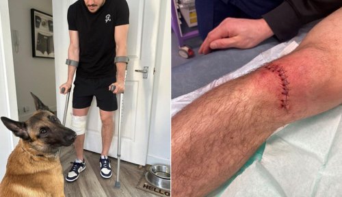 Nathaniel Wood withdraws from UFC 286 after 'freak accident' causes nasty gash