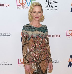 Anne Heche’s Cause of Death Officially Confirmed by Coroner