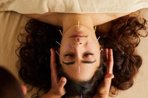 How Acupuncture Can Help Treat Insomnia