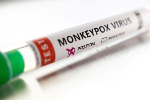 First Case of Monkeypox Confirmed in Ireland