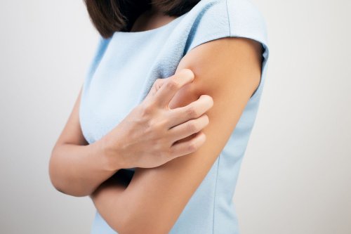 can-menopause-cause-a-rash-and-itchy-skin-flipboard