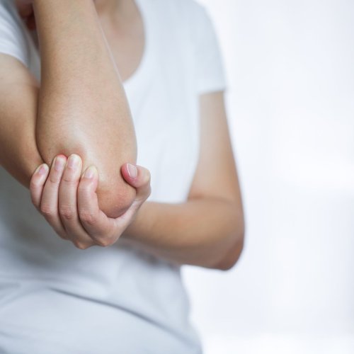 What Is Rheumatoid Arthritis in the Elbow?