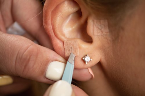 What Are Ear Seeds, And Do They Work?