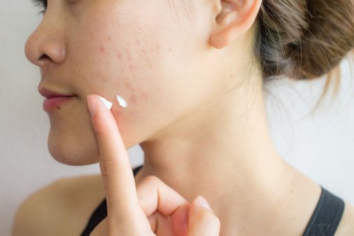 6 Popular Acne Products Are Being Recalled Over Cancer-Causing Chemical