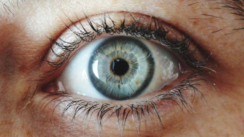 What Is the Rarest Eye Color?