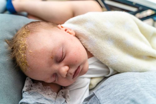 How to Spot and Take Care of Your Baby’s Rash