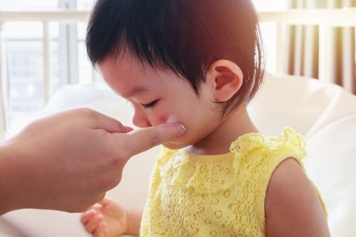 how-to-treat-toddler-eczema-flipboard