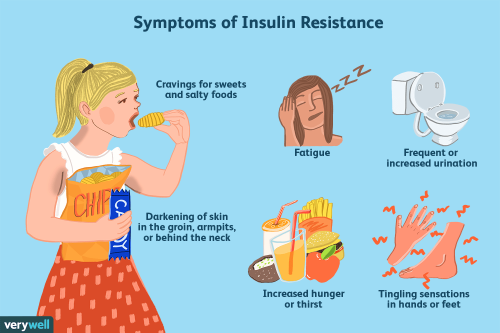 PCOS and Insulin Resistance