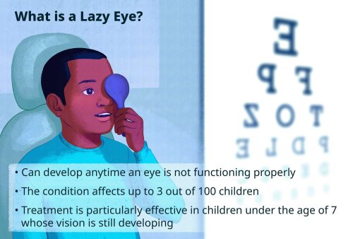 Lazy Eye: Causes and Treatment | Flipboard