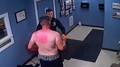 A Man Caught Fire After Being Tased. Cops Ran Out of the Room, Video Shows.