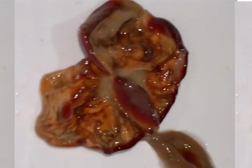 Woman ‘Violently Ill’ After Finding Fleshy-Looking Blob in Her Juice