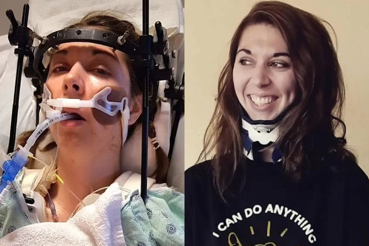 Doctors Reattached Decapitated Woman’s Head After Freak Gym Accident