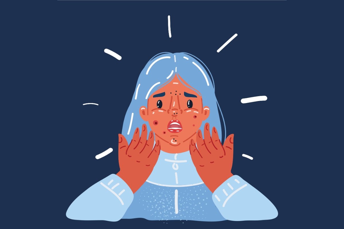 This Virus Clears Acne by Infecting the Bacteria That Causes It