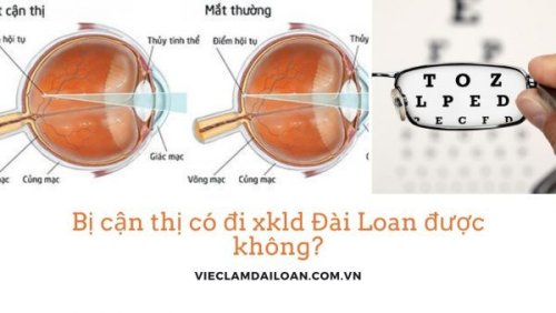 Bị cận thị có đi XKLD Đài Loan được không?