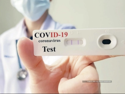 CDC Now Says You Need To Get Tested For Domestic Travel